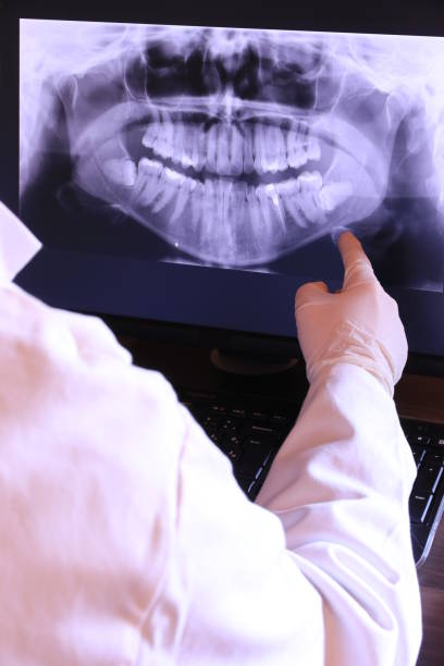 Best Emergency Wisdom Teeth Removal in Manteo, NC